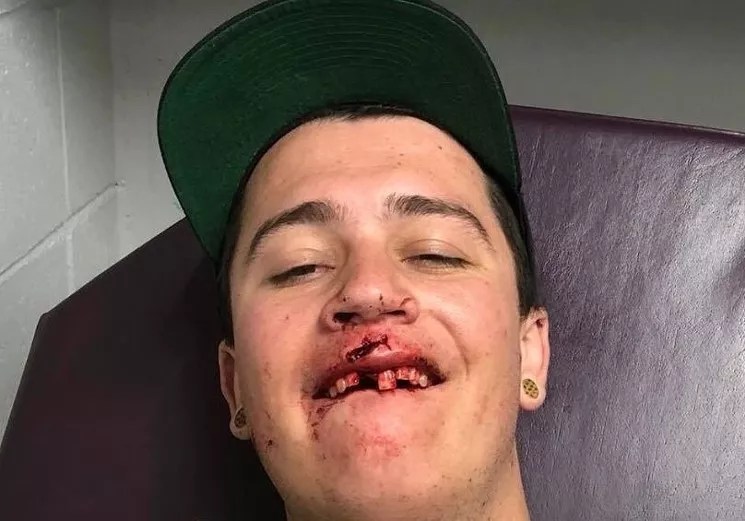 Readers: Denver Jam-Band Concerts Are Violent