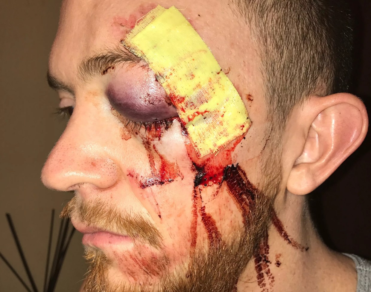 Man Assaulted at Red Rocks Sues Argus After Guard Allegedly Did Nothing to Help