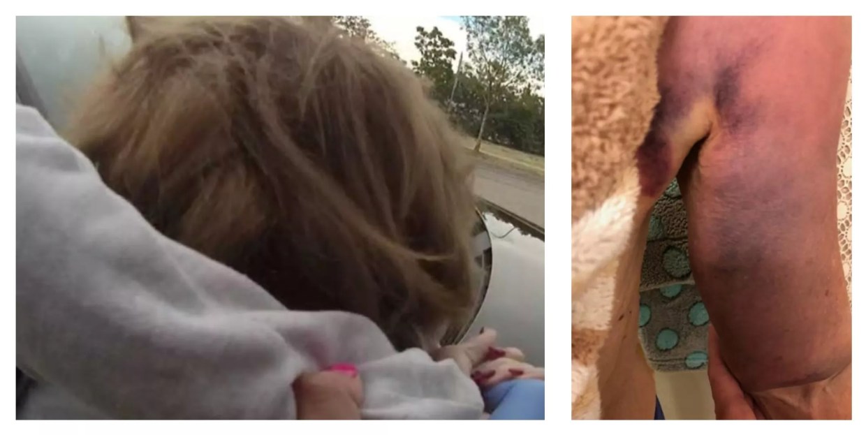 Video: Loveland Cops’ Rough Bust of Elderly Woman With Dementia