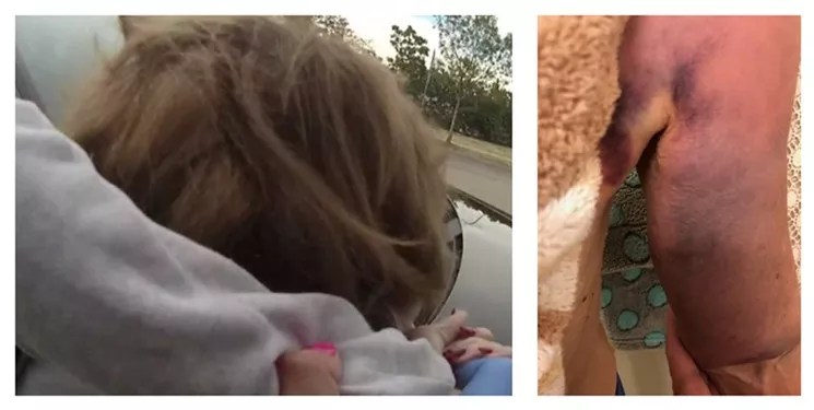 Cop Charged in Rough Dementia Patient Bust: She’s “Frail” but “Wily”